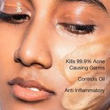 MCaffeine Anti Acne Coffee Foaming Face Wash – Oil & Pimple Control Cleanser with Cinnamon & Vitamin E (75ml)